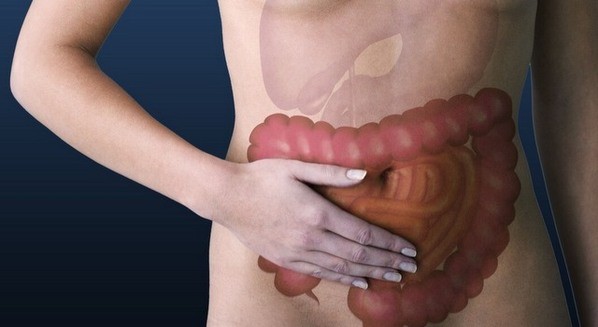 Imagem do intestino e apêndice vermiforme, que quando se inflama provoca apendicite.