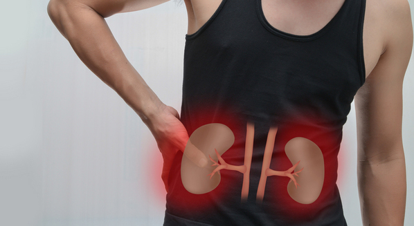 Dor nos rins: causas, sintomas e tratamento da cólica renal