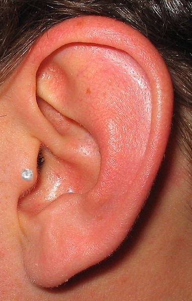 Piercing No Tragus Inflamado O Que Fazer Medico Responde